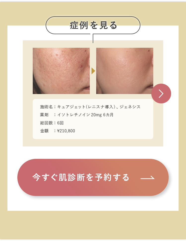 症例を見て予約する1