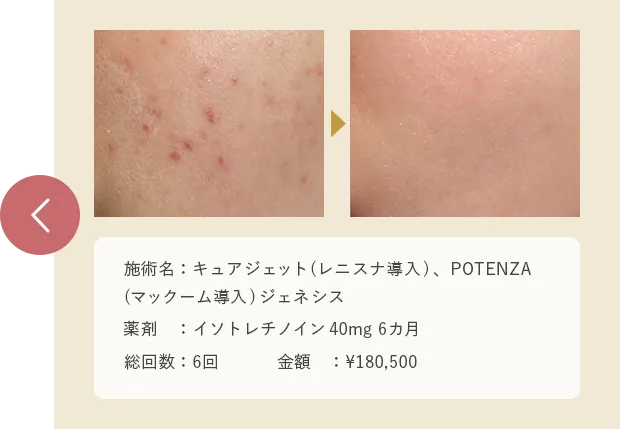 症例を見て予約する2