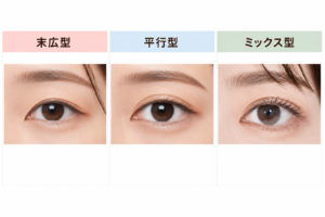 末広型・ミックス型・平行型の二重の違いを示す図